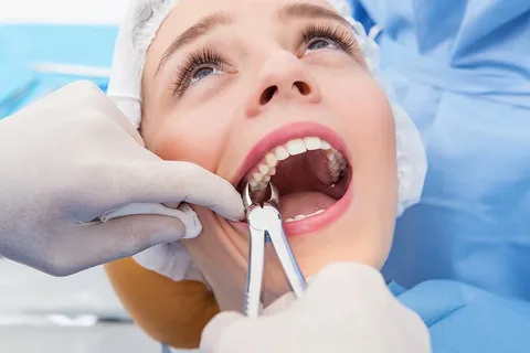 Tooth extractions Alexandria